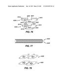 Devices and Methods for Sealing Staples in Tisue diagram and image