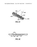 Devices and Methods for Sealing Staples in Tisue diagram and image