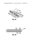 Devices and Methods for Sealing Staples in Tisue diagram and image