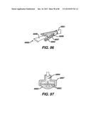 Devices and Methods for Sealing Staples in Tisue diagram and image