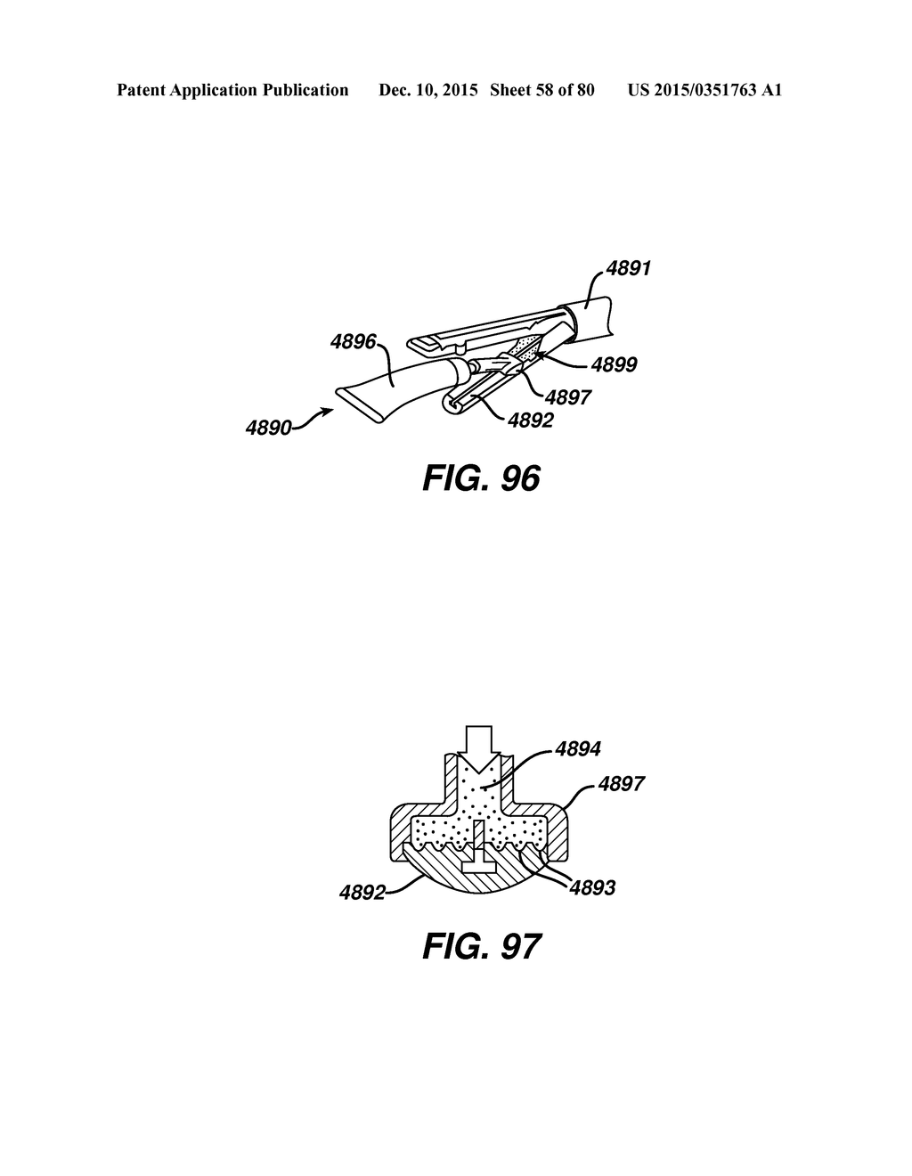 Devices and Methods for Sealing Staples in Tisue - diagram, schematic, and image 59