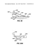 Devices and Methods for Sealing Staples in Tisue diagram and image