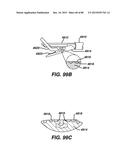 Devices and Methods for Sealing Staples in Tisue diagram and image