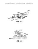 Devices and Methods for Sealing Staples in Tisue diagram and image