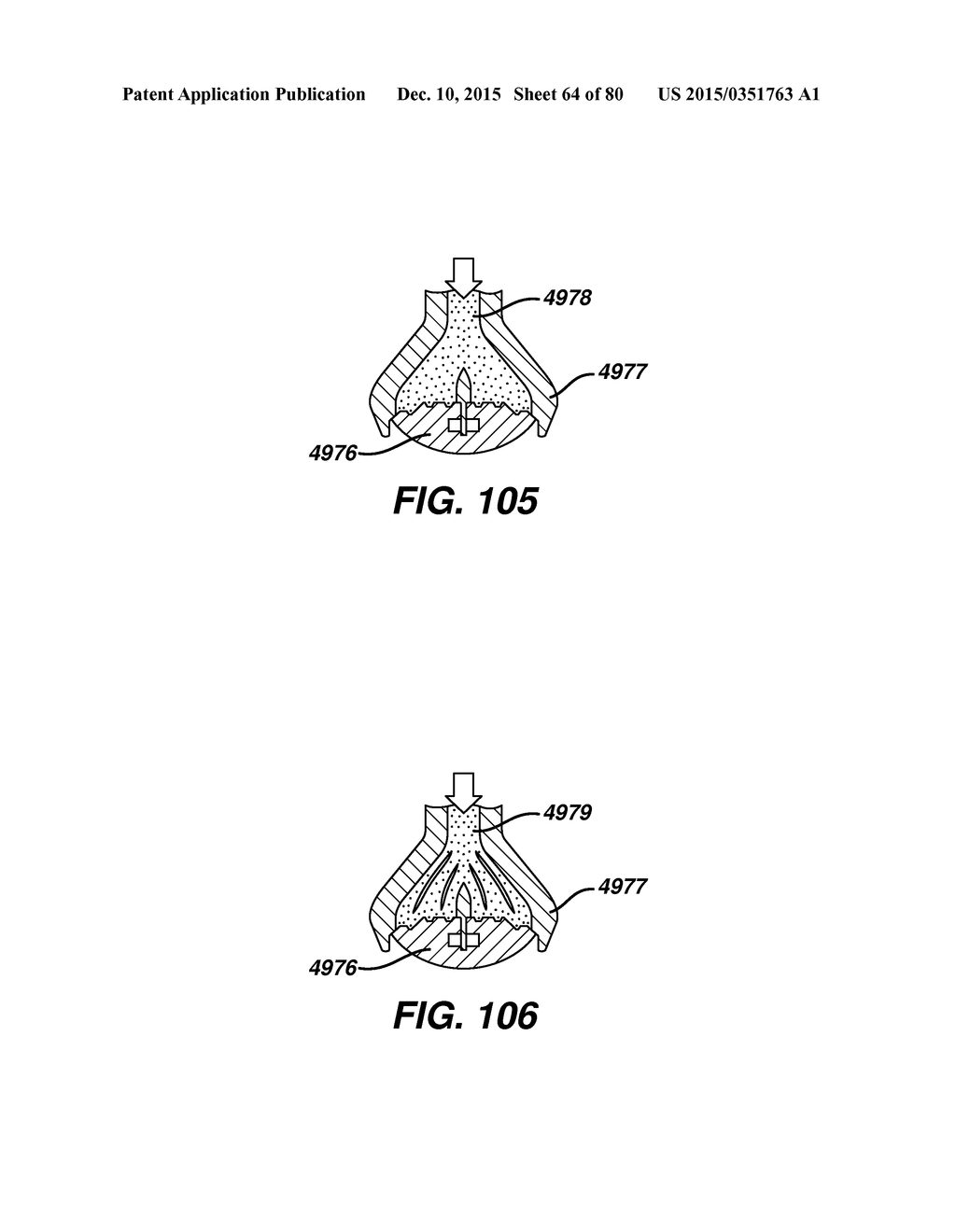 Devices and Methods for Sealing Staples in Tisue - diagram, schematic, and image 65