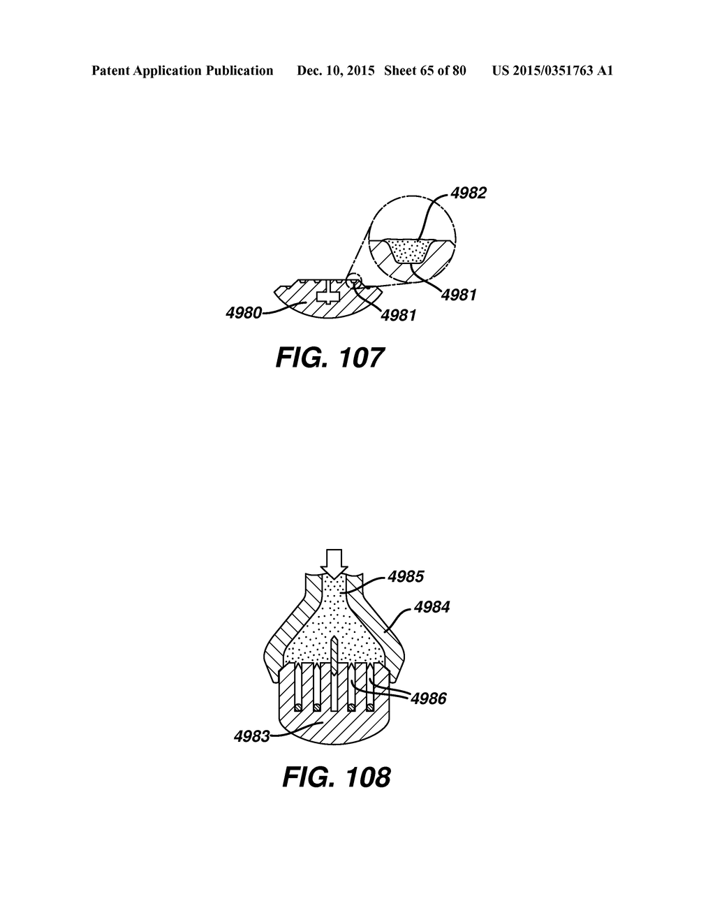 Devices and Methods for Sealing Staples in Tisue - diagram, schematic, and image 66