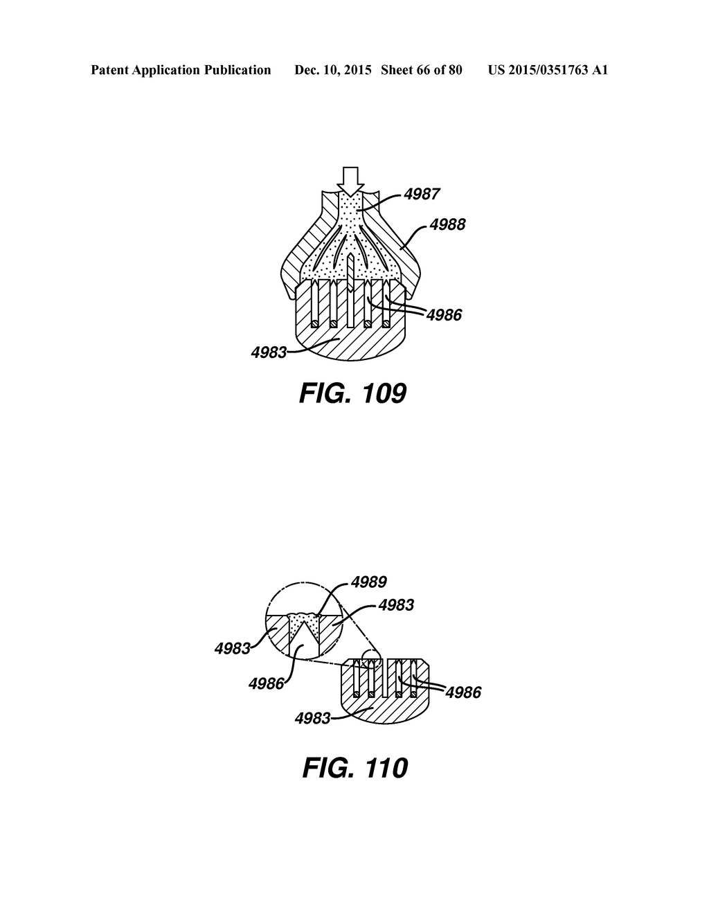 Devices and Methods for Sealing Staples in Tisue - diagram, schematic, and image 67