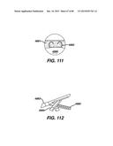 Devices and Methods for Sealing Staples in Tisue diagram and image