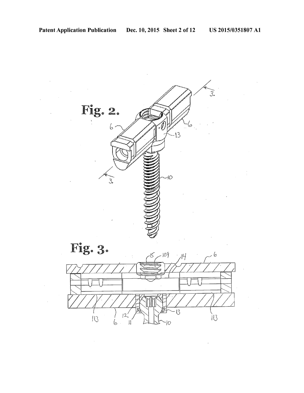 POLYAXIAL BONE ANCHOR WITH POLYMER SLEEVE - diagram, schematic, and image 03