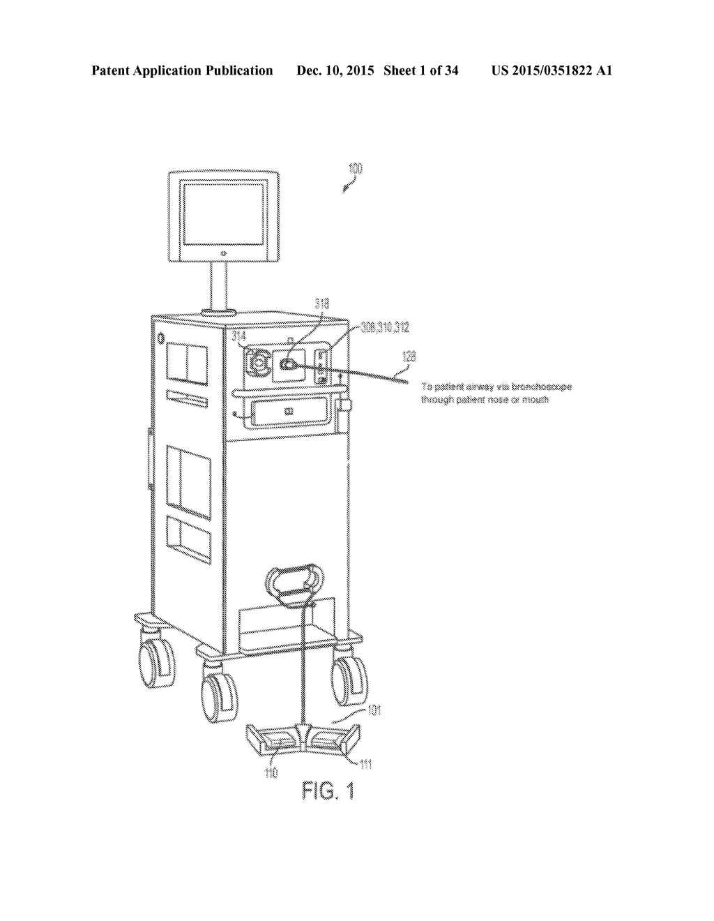 METHOD AND SYSTEM FOR CONSISTENT, REPEATABLE, AND SAFE CRYOSPRAY TREATMENT     OF AIRWAY TISSUE - diagram, schematic, and image 02