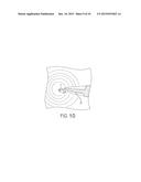 METHOD AND SYSTEM FOR CONSISTENT, REPEATABLE, AND SAFE CRYOSPRAY TREATMENT     OF AIRWAY TISSUE diagram and image