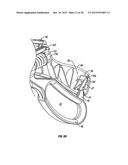 ENDOSCOPIC VESSEL SEALER AND DIVIDER FOR LARGE TISSUE STRUCTURES diagram and image