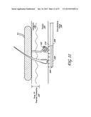 METHODS AND APPARATUS FOR REDUCING SWEAT PRODUCTION diagram and image