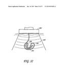 METHODS AND APPARATUS FOR REDUCING SWEAT PRODUCTION diagram and image