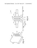 METHODS AND APPARATUS FOR REDUCING SWEAT PRODUCTION diagram and image