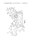 SELF-LIGATING ORTHODONTIC BRACKET diagram and image