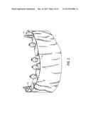 COMPONENTS FOR  PERMANENT REMOVABLE AND ADJUSTABLE DENTURES AND BRIDGES diagram and image