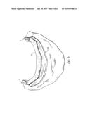 COMPONENTS FOR  PERMANENT REMOVABLE AND ADJUSTABLE DENTURES AND BRIDGES diagram and image