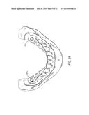 COMPONENTS FOR  PERMANENT REMOVABLE AND ADJUSTABLE DENTURES AND BRIDGES diagram and image