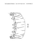 COMPONENTS FOR  PERMANENT REMOVABLE AND ADJUSTABLE DENTURES AND BRIDGES diagram and image