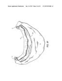 COMPONENTS FOR  PERMANENT REMOVABLE AND ADJUSTABLE DENTURES AND BRIDGES diagram and image