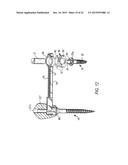 COMPONENTS FOR  PERMANENT REMOVABLE AND ADJUSTABLE DENTURES AND BRIDGES diagram and image