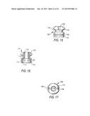 COMPONENTS FOR  PERMANENT REMOVABLE AND ADJUSTABLE DENTURES AND BRIDGES diagram and image