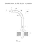 SYSTEMS AND METHODS FOR MASTOPEXY diagram and image