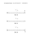 SYSTEMS AND METHODS FOR MASTOPEXY diagram and image