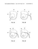 SYSTEMS AND METHODS FOR MASTOPEXY diagram and image