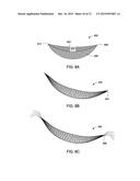 SYSTEMS AND METHODS FOR MASTOPEXY diagram and image