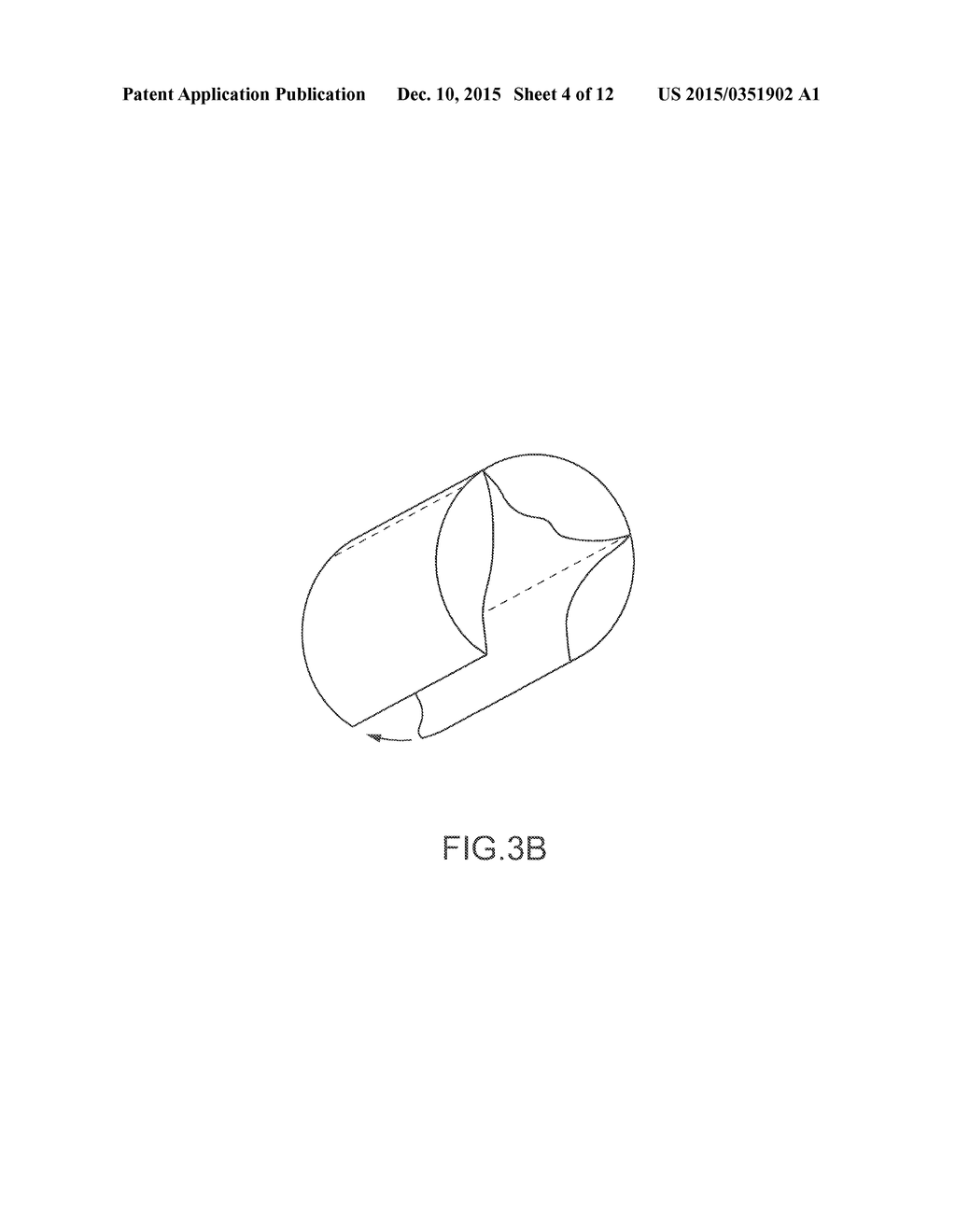 PERCUTANEOUSLY IMPLANTABLE REPLACEMENT HEART VALVE DEVICE AND METHOD OF     MAKING SAME - diagram, schematic, and image 05