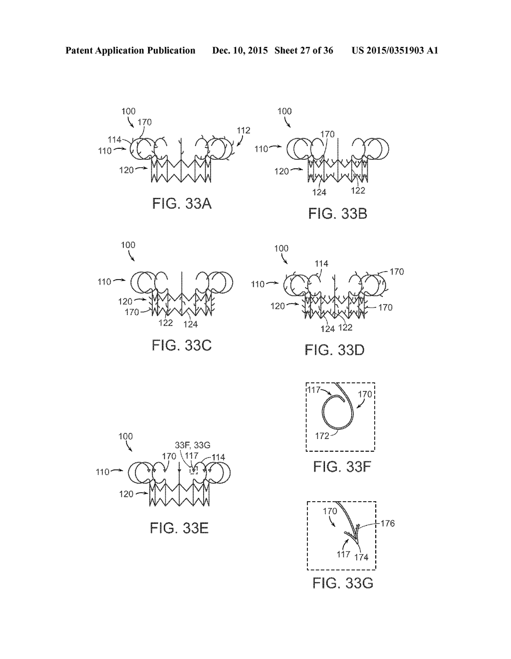 DEVICES, SYSTEMS AND METHODS FOR HEART VALVE REPLACEMENT - diagram, schematic, and image 28