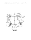 DEVICES FOR REMODELING A VALVE ANNULUS AND VENTRICLE diagram and image