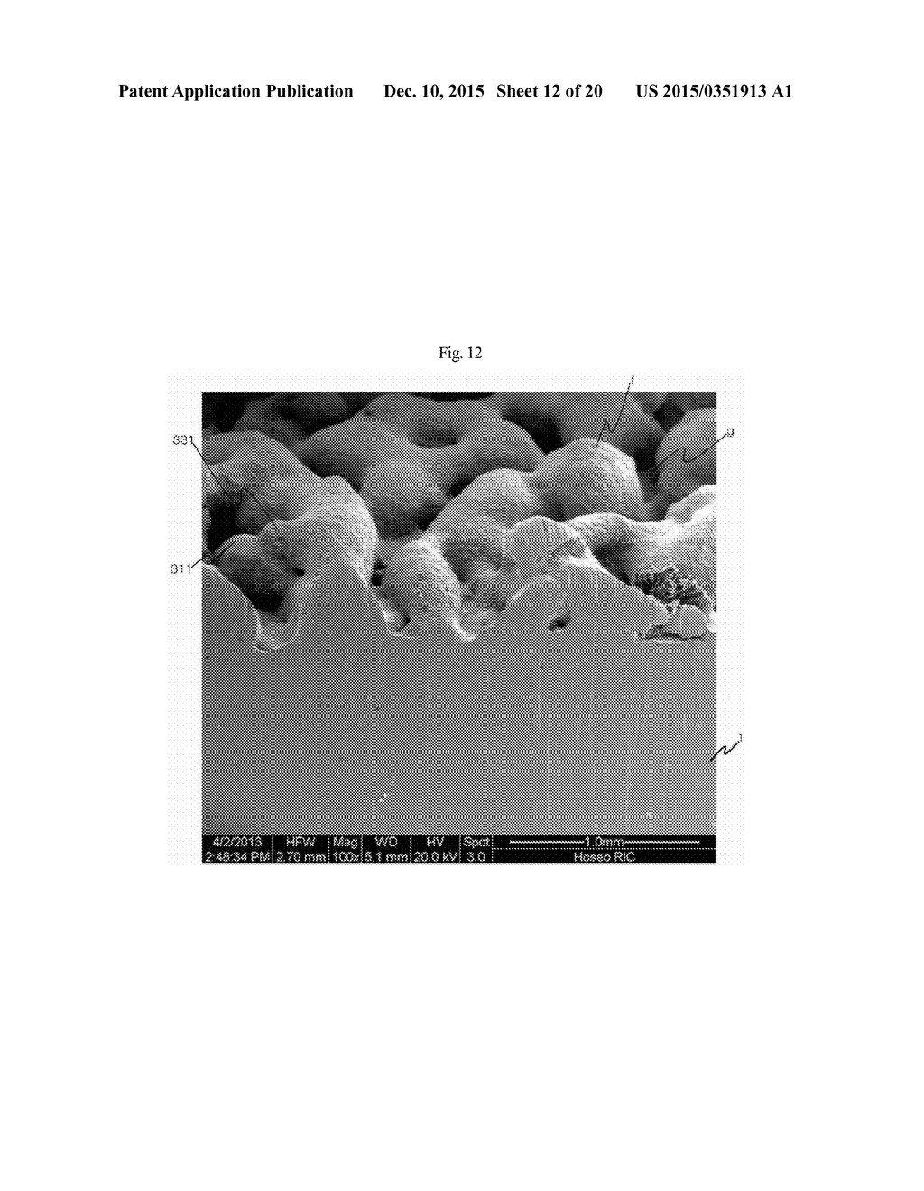 METHOD FOR MANUFACTURING IMPLANT HAVING POROUS LAYER ON SURFACE THEREOF - diagram, schematic, and image 13