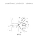 TUMID IMPLANT AND PUMP diagram and image