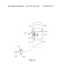 TUMID IMPLANT AND PUMP diagram and image