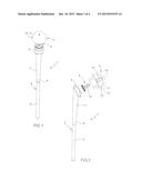 MODULAR SPACER DEVICE FOR THE TREATMENT OF PROSTHESIS INFECTIONS diagram and image