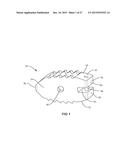 PIVOTABLE INTERBODY IMPLANT SYSTEM diagram and image