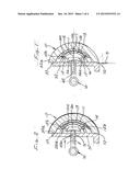 Separation of hip joint liner and socket elements diagram and image