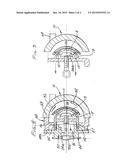 Separation of hip joint liner and socket elements diagram and image