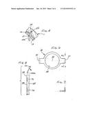 Separation of hip joint liner and socket elements diagram and image