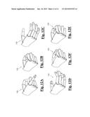 PROSTHETIC HAND SYSTEM diagram and image