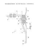 ARTIFICIAL FOOT diagram and image