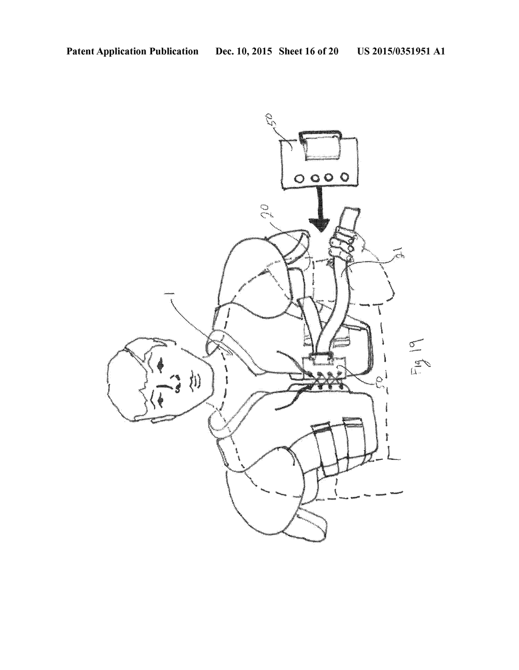 SHOULDER STABILIZATION APPARATUS AND METHODS - diagram, schematic, and image 17