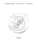 THERAPEUTIC AGENT DELIVERY DEVICE WITH CONVERGENT LUMEN diagram and image