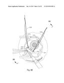 THERAPEUTIC AGENT DELIVERY DEVICE WITH CONVERGENT LUMEN diagram and image