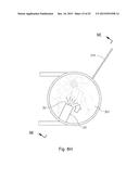 THERAPEUTIC AGENT DELIVERY DEVICE WITH CONVERGENT LUMEN diagram and image