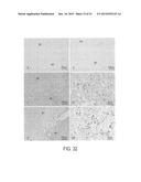 Methods and Compositions for Treating Trauma-Hemorrhage Using Estrogen and     Derivatives Thereof diagram and image