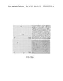 Methods and Compositions for Treating Trauma-Hemorrhage Using Estrogen and     Derivatives Thereof diagram and image